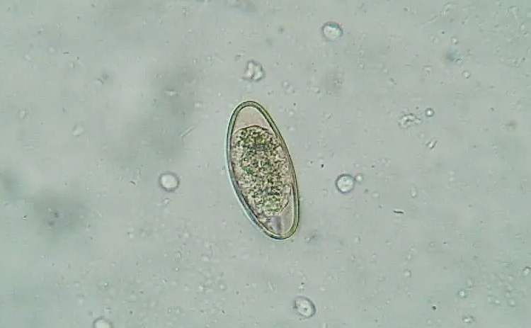寄生虫感染症の原因は何ですか?